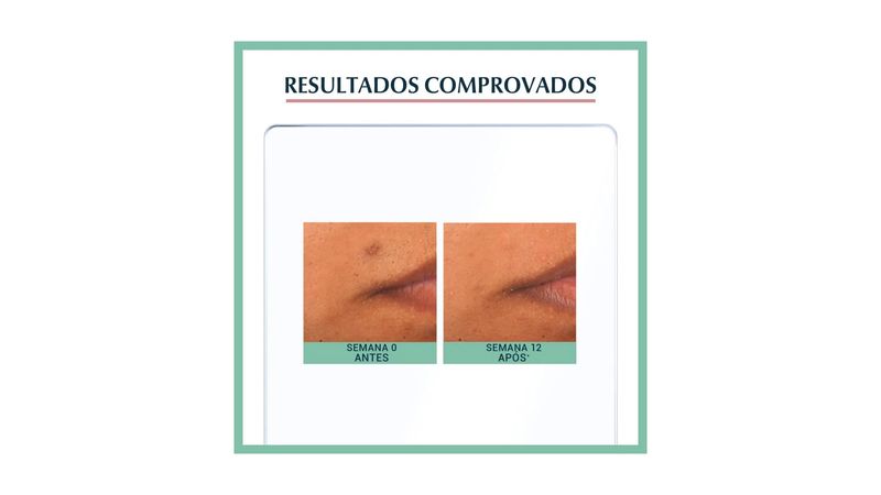 compreserumfacial