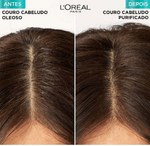 COMPRE-HIDRA-HIALURONICO-SHAMPOO-1